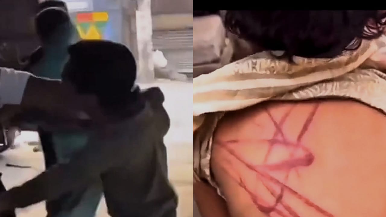 مارة يضربون ويجرون والدا في الشارع بعد اكتشاف تعذيبه لطفلته .. فيديو