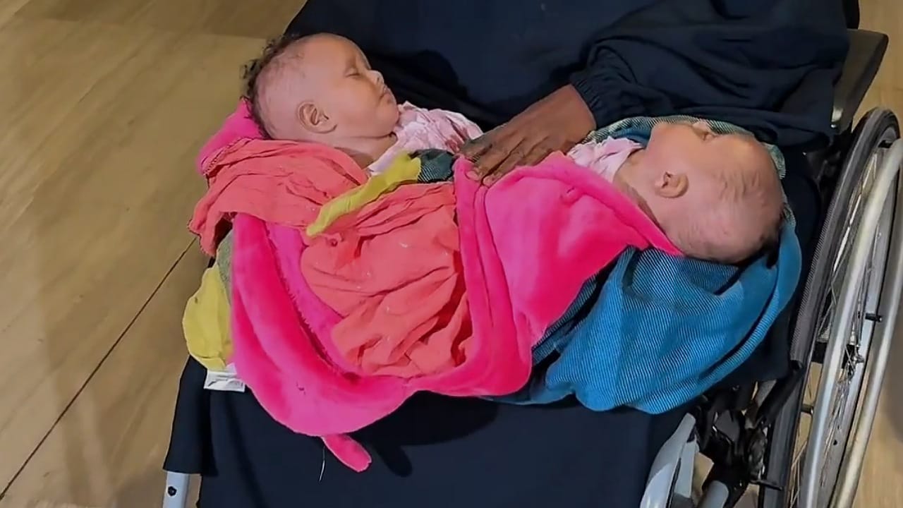 وصول التوأم السيامي الصومالي إلى الرياض لدراسة إمكانية فصلهما .. فيديو