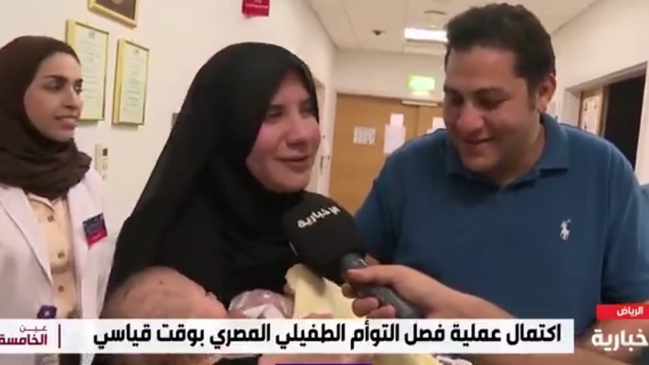 دموع وفرح بعد نجاح فصل التوأم الطفيلي المصري بوقت قياسي.. فيديو