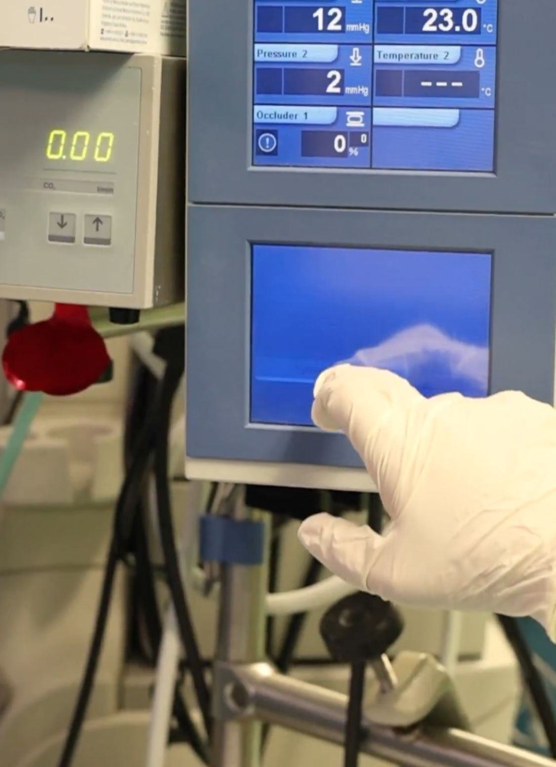 نجاح أول عملية قلب مفتوح لحاج في المدينة المنورة فيديو