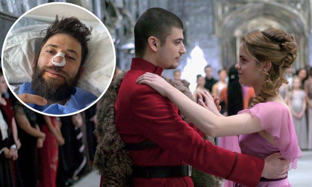 نجم هاري بوتر يخضع لعملية جراحية بسبب عدم قدرته على التنفس