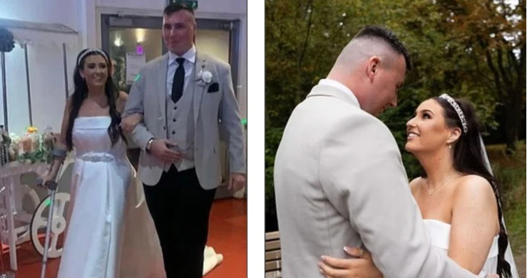 عملية تكميم تحول حياة عروس لكابوس قبل حفل زفافها.. صور