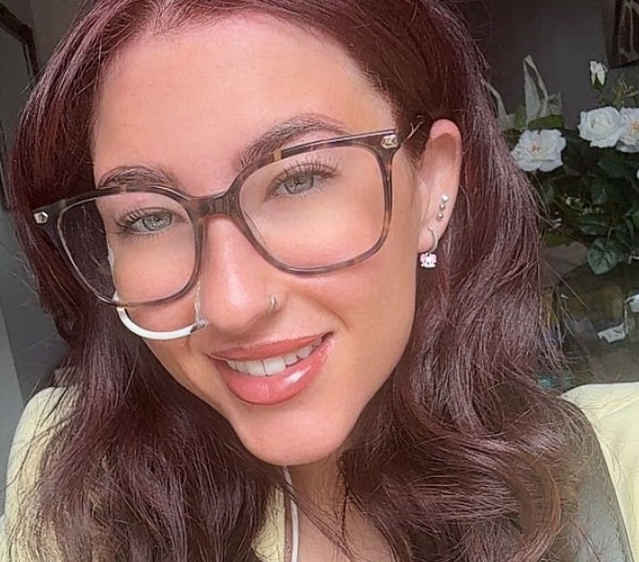 عملية تكميم تحول حياة عروس لكابوس قبل حفل زفافها.. صور