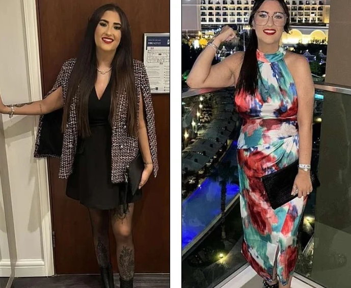 عملية تكميم تحول حياة عروس لكابوس قبل حفل زفافها.. صور