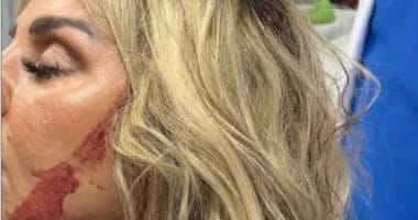 رزان مغربي تغادر المستشفى بعد جراحة دقيقة في الرأس