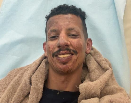 فزعة أبطال: خمسة شبان من قلوة ينقذون شابا من مركبة مشتعلة