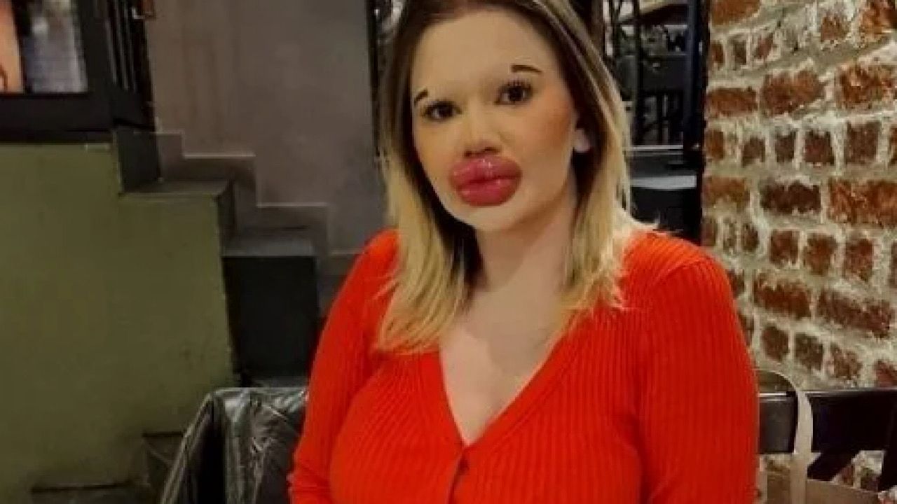 فتاة تحرم من العلاج بسبب الفيلر