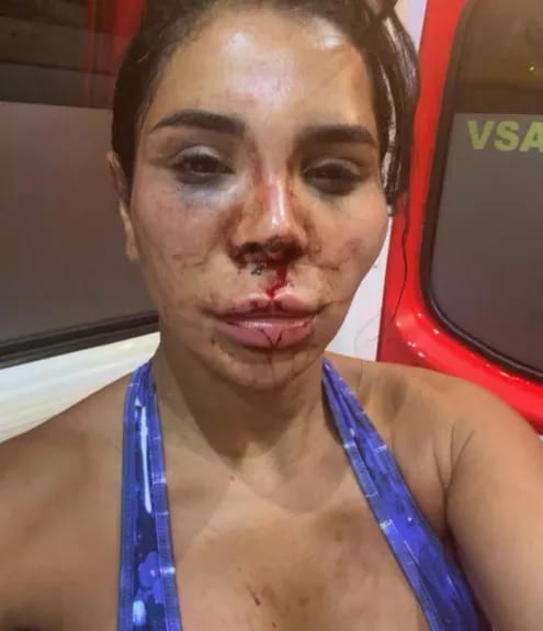 مؤثرة فرنسية تتعرض لاعتداء عنيف وسرقة في منزلها