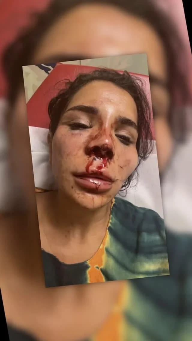 مؤثرة فرنسية تتعرض لاعتداء عنيف وسرقة في منزلها