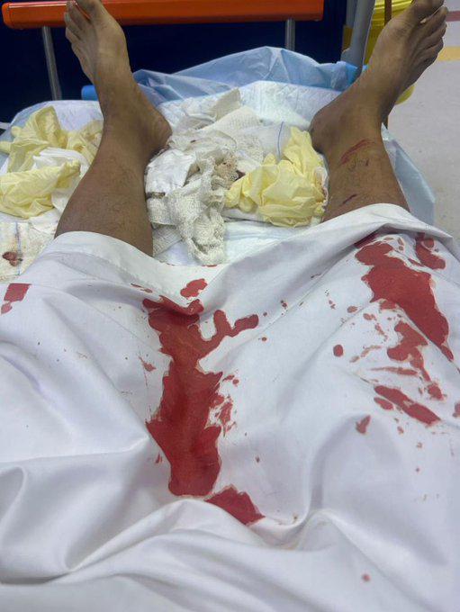 قصة هجوم ذئب على مواطن من أهالي جبه بحائل.. فيديو