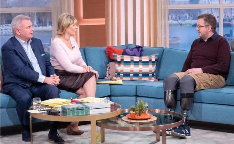 طبيب يبتر ساقيه عمدا للحصول على تعويضات مالية