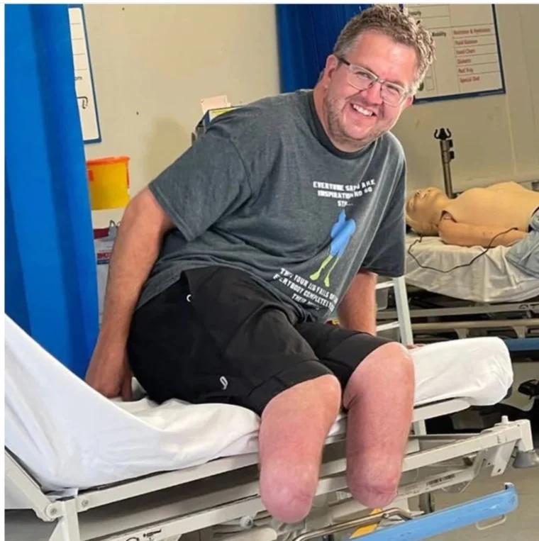 طبيب يبتر ساقيه عمدا للحصول على تعويضات مالية