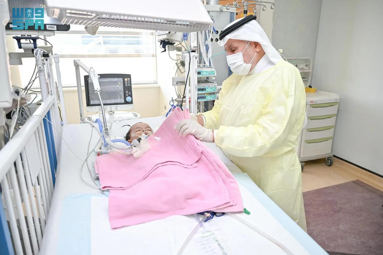 الربيعة: استقرار حالة التوأم الملتصق السعودي يارا ولارا بعد 4 أيام من العملية.. فيديو وصور