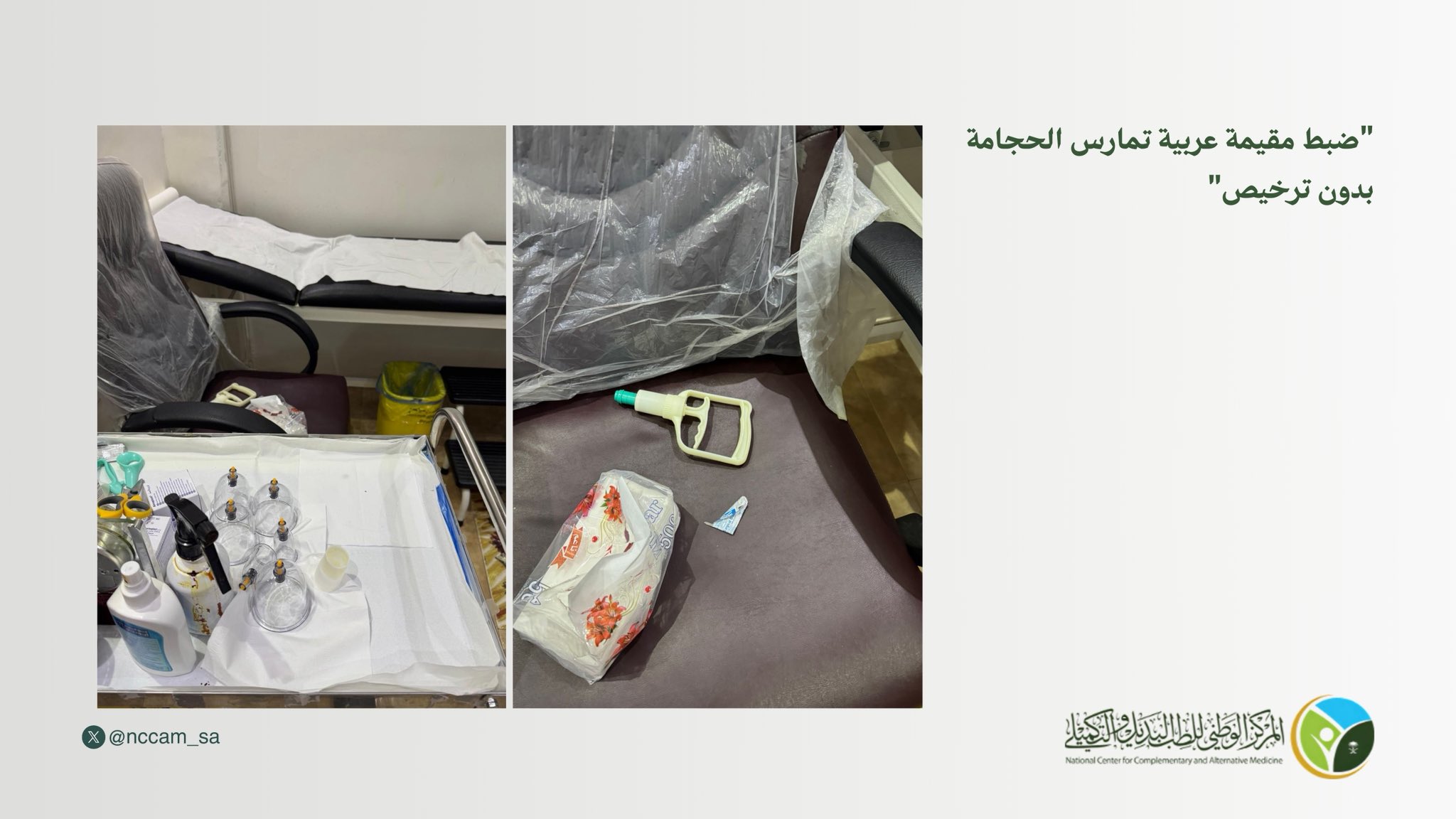 ضبط مقيمة عربية تمارس الحجامة دون ترخيص بحفر الباطن