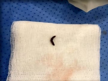 بوقت قياسي.. فريق مسار السكتات الدماغية ينقذ حياة مريضة