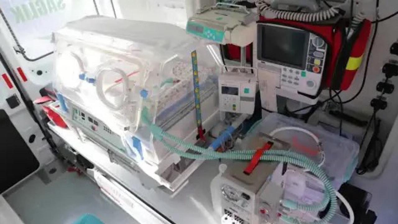 ولادة نادرة لطفل بجلد سمكة