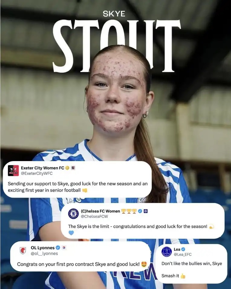 حبوب الشباب تحرم لاعبة شابة من فرحة تقديمها