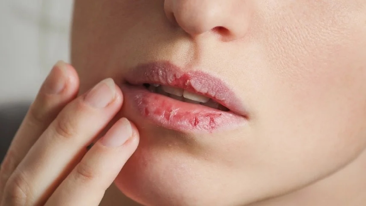 علامات في الشفاه تنبئ بمخاطر صحية محتملة