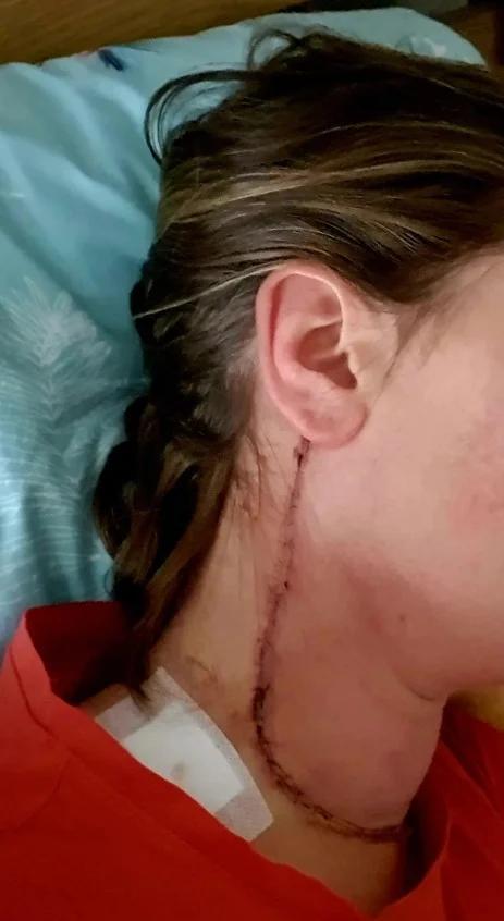 رقائق الشيبسي تنقذ فتاة من سرطان خفي