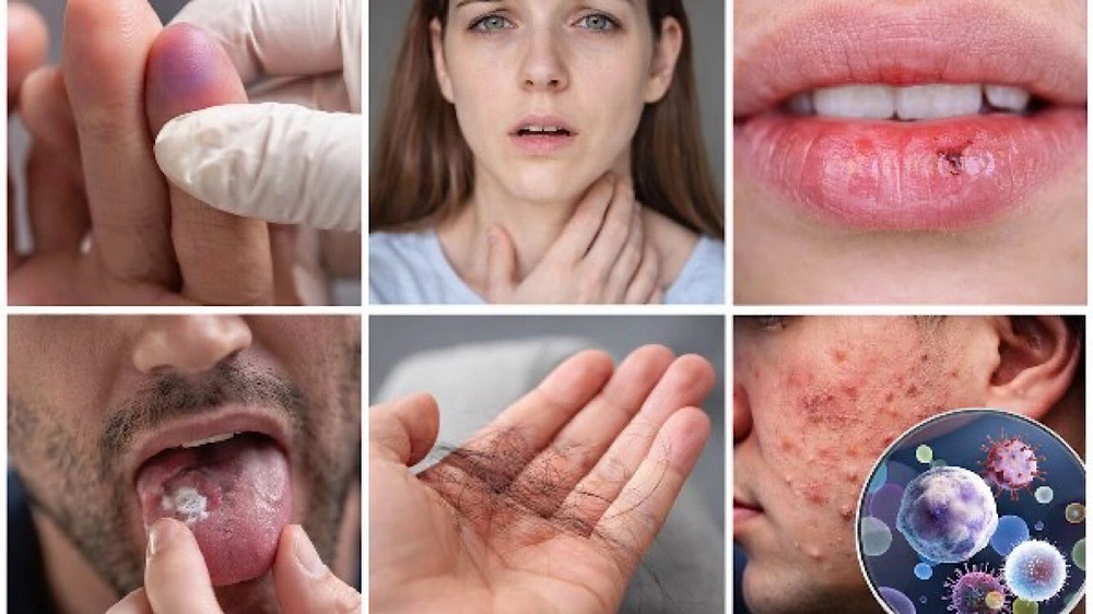 علامة واحدة في جسدك قد تكشف نقص فيتامين خطير