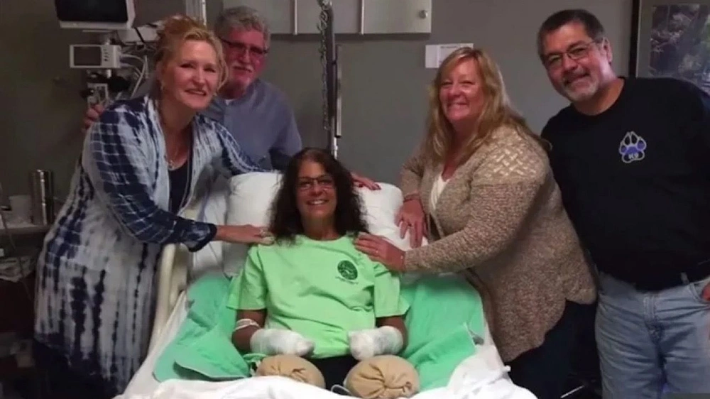 سيدة تفقد ساقيها وذراعيها بسبب حضن من كلبها..صور