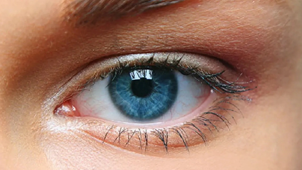 3 مخاطر للسكري على العين .. فيديو