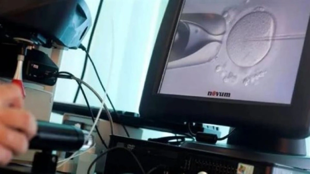 ابتكار تقنية تجدد البويضات وتقلل التشوهات لدى الأجنة