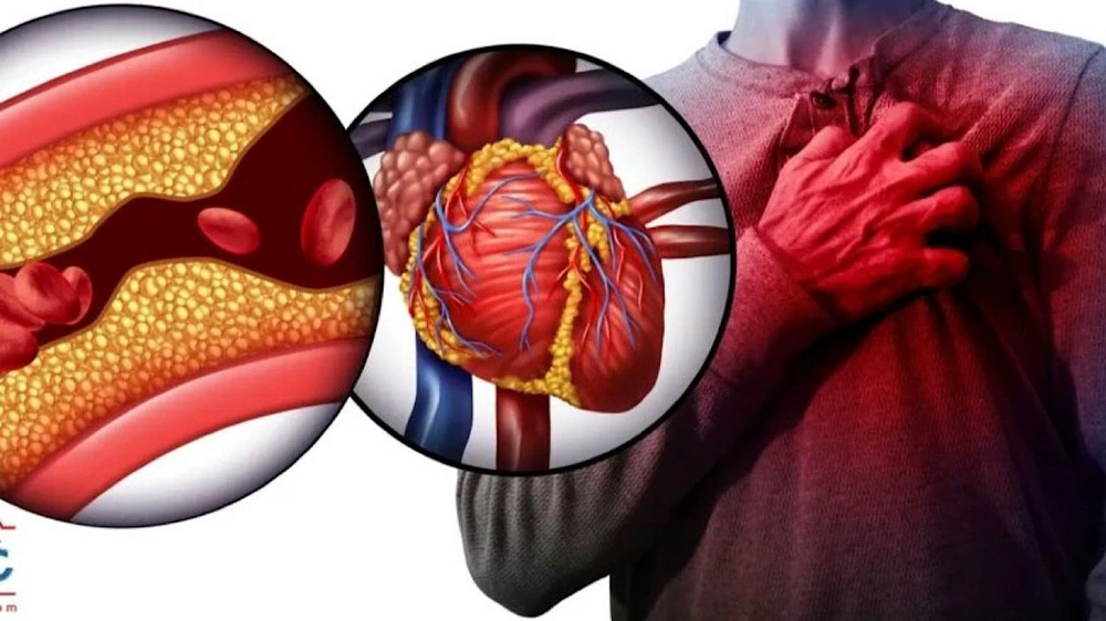 النمر : 40% من حالات أول جلطة قلبية تحدث قبل سن 55