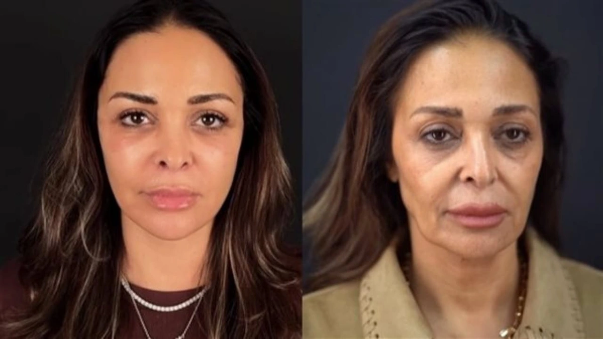 داليا البحيري تكشف خضوعها لعملية شد الوجه والرقبة والجفون وتشارك تجربتها .. فيديو