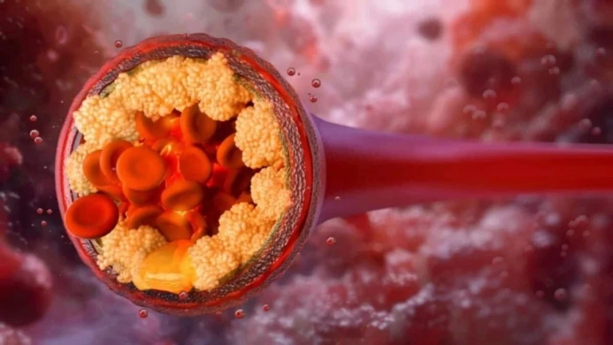 دواء يقلل دهون الدم الضارة بنسبة 50%