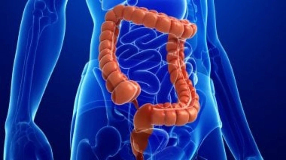 عامل خطير يؤدي إلى الإصابة بسرطان القولون