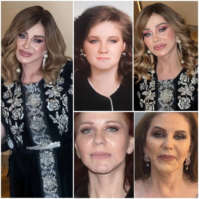 ميادة الحناوي تثير الجدل بظهورها بملامح شبابية مفاجئة