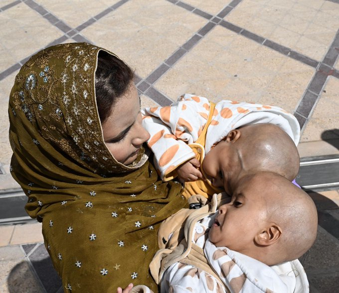 وصول التوأم الملتصق الباكستانيسفيان ويوسف إلى الرياض.. صور