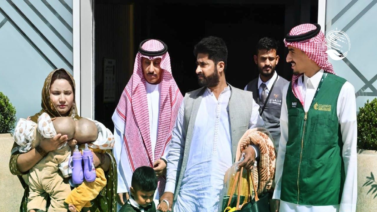 وصول التوأم الملتصق الباكستاني”سفيان ويوسف” إلى الرياض.. صور