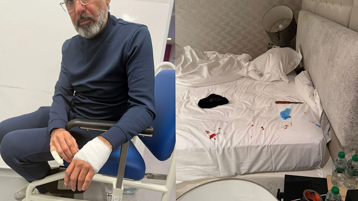 ‏محاولة اغتيال فواز الحساوي رئيس نادي القادسية الكويتي في لندن.. صور