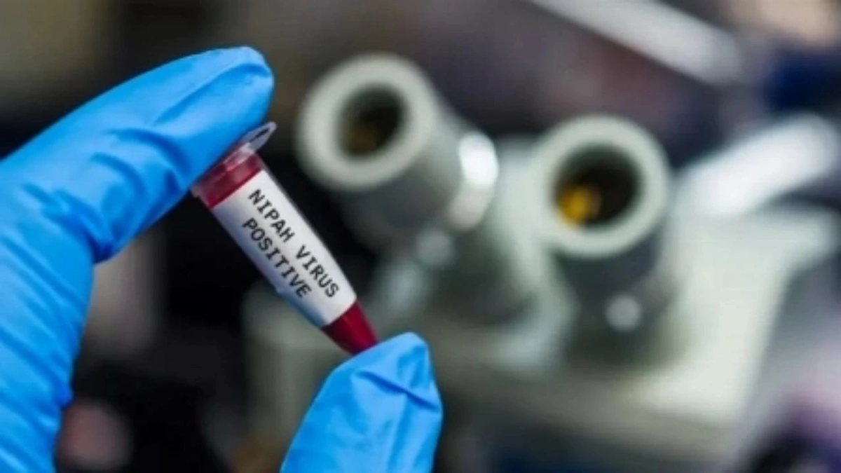 اليابان تبدأ أول تجربة بشرية للقاح مضاد لفيروس نيباه القاتل