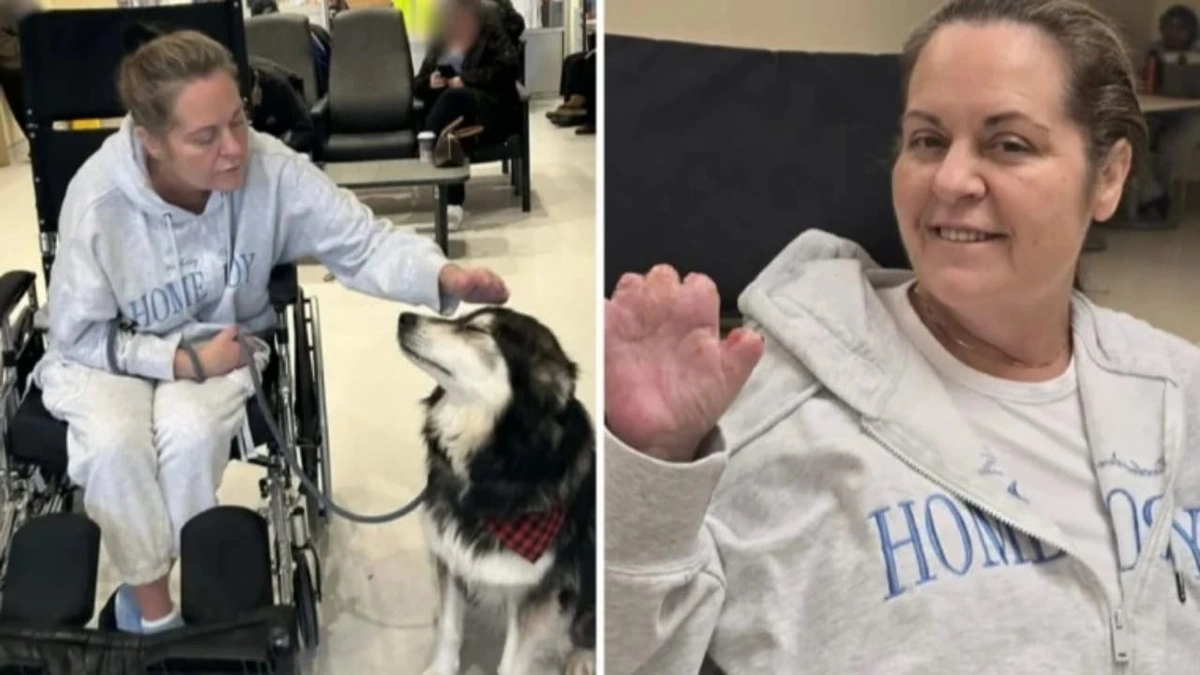 مضاعفات خطيرة تحرم سيدة كندية من أطرافها بعد عملية تجميل