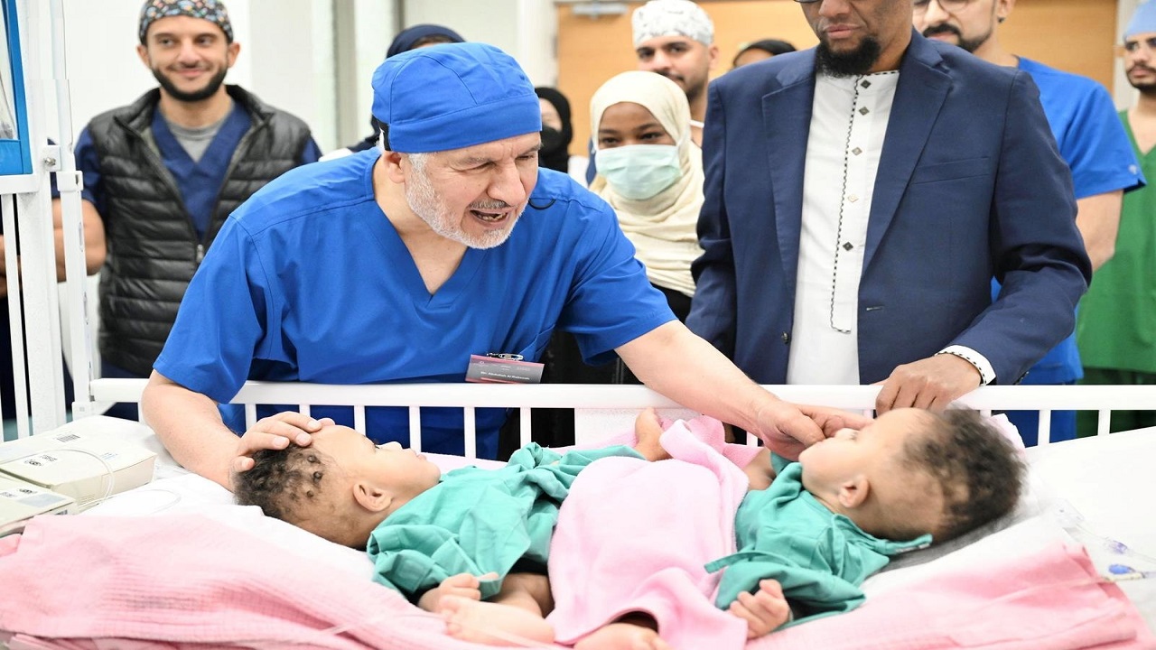 بدء عملية فصل التوأم الملتصق الصومالي رحمة ورملا في الرياض.. صور