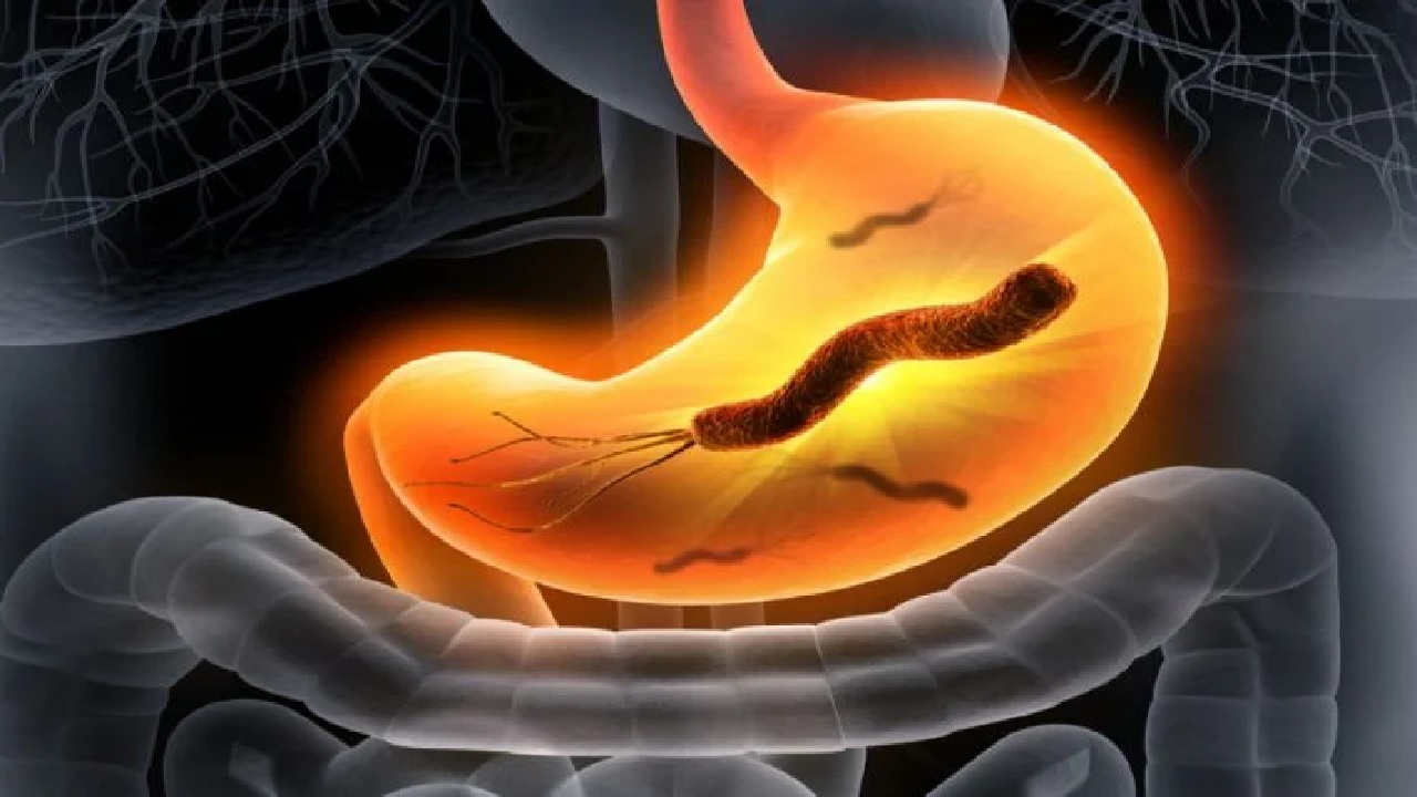 أبرز أعراض جرثومة المعدة المتكررة والمزعجة