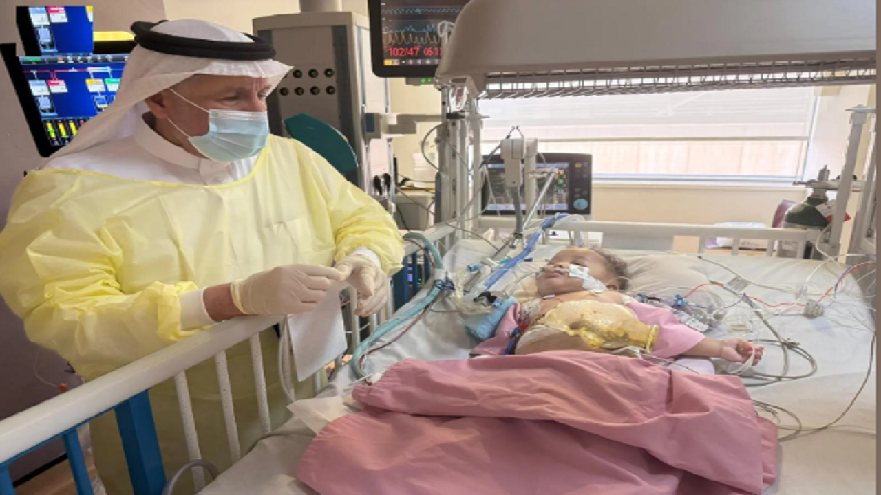 الدكتور الربيعة: استقرار حالة التوأم الصومالي “رحمة ورملا” بعد 4 أيام من عملية فصلهما