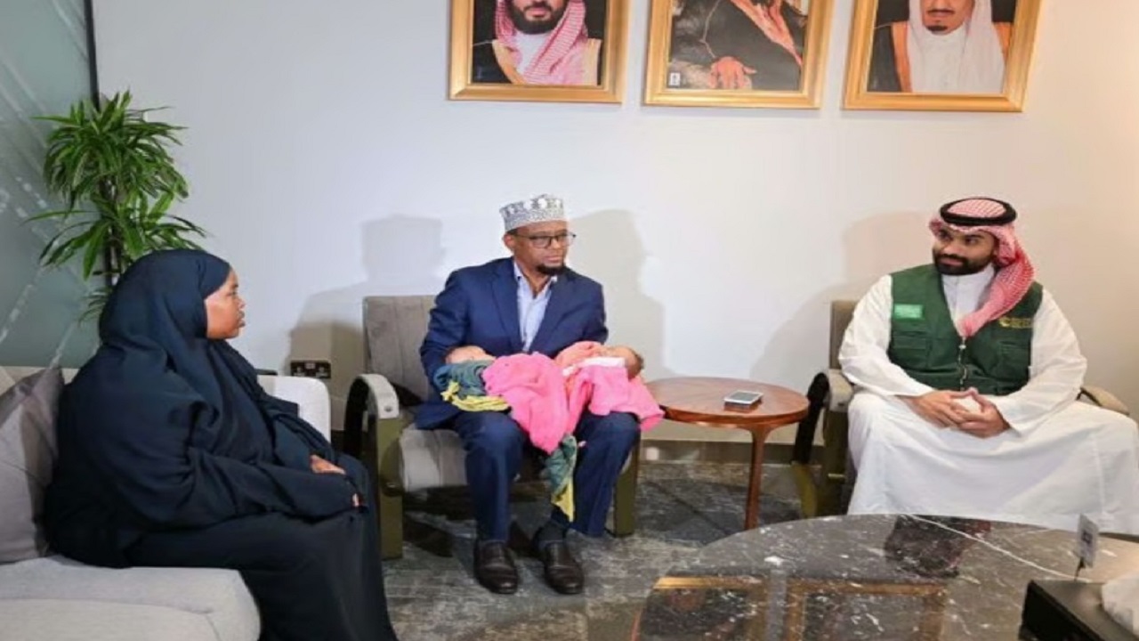 بدء عملية فصل التوأم الملتصق الصومالي رحمة ورملا في الرياض