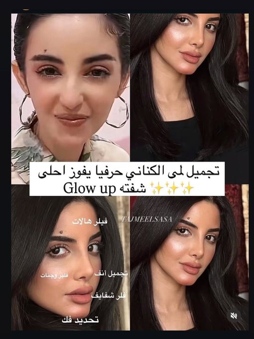 لقطات تكشف ملامح لمى الكناني قبل وبعد عمليات التجميل.. صور