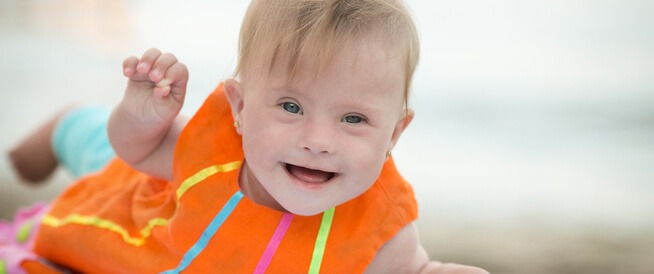 علماء أمريكيون يتوصلون إلى تقنية حديثة لعلاج متلازمة داون