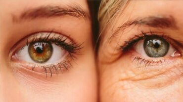 خبراء: العينين قد تكونان نافذة مبكرة لاكتشاف خلل في وظائف الكبد