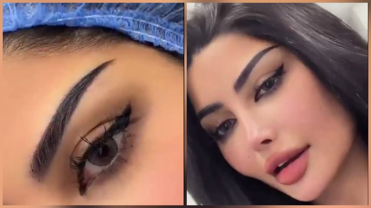 ملكة كابلي بعد زراعة الحواجب: بدون مبالغة أحلى حواجب شفتها بحياتي.. فيديو