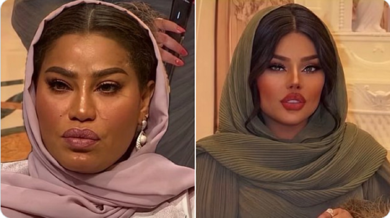 موضي الشمراني تثير تفاعلًا واسعًا بعد التجميل