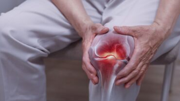نصائح احرص عليها لمفاصل صحية بعيدًا عن الخشونة.. فيديو