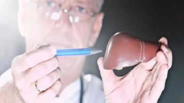 أنماط حياتية يجب تغيرها لعلاج دهون الكبد