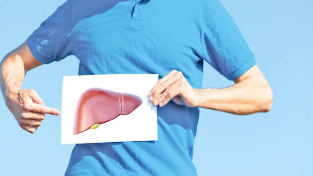 علاج تجريبي مزدوج يظهر نتائج واعدة لمرضى الكبد الدهني