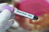 بدء أولى تجارب علاج سلالة “بونديبوغيو” من الإيبولا في الكونغو